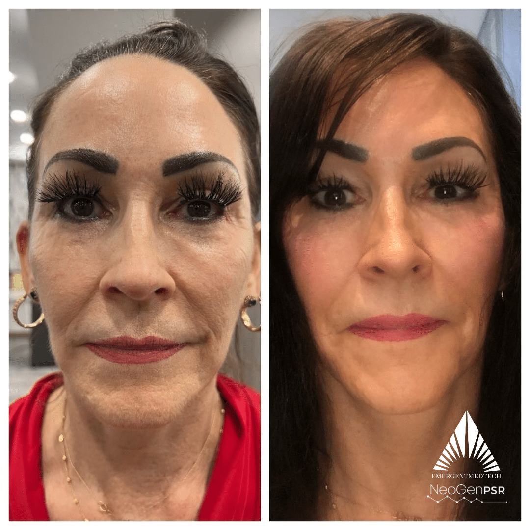 14 (Full face)
