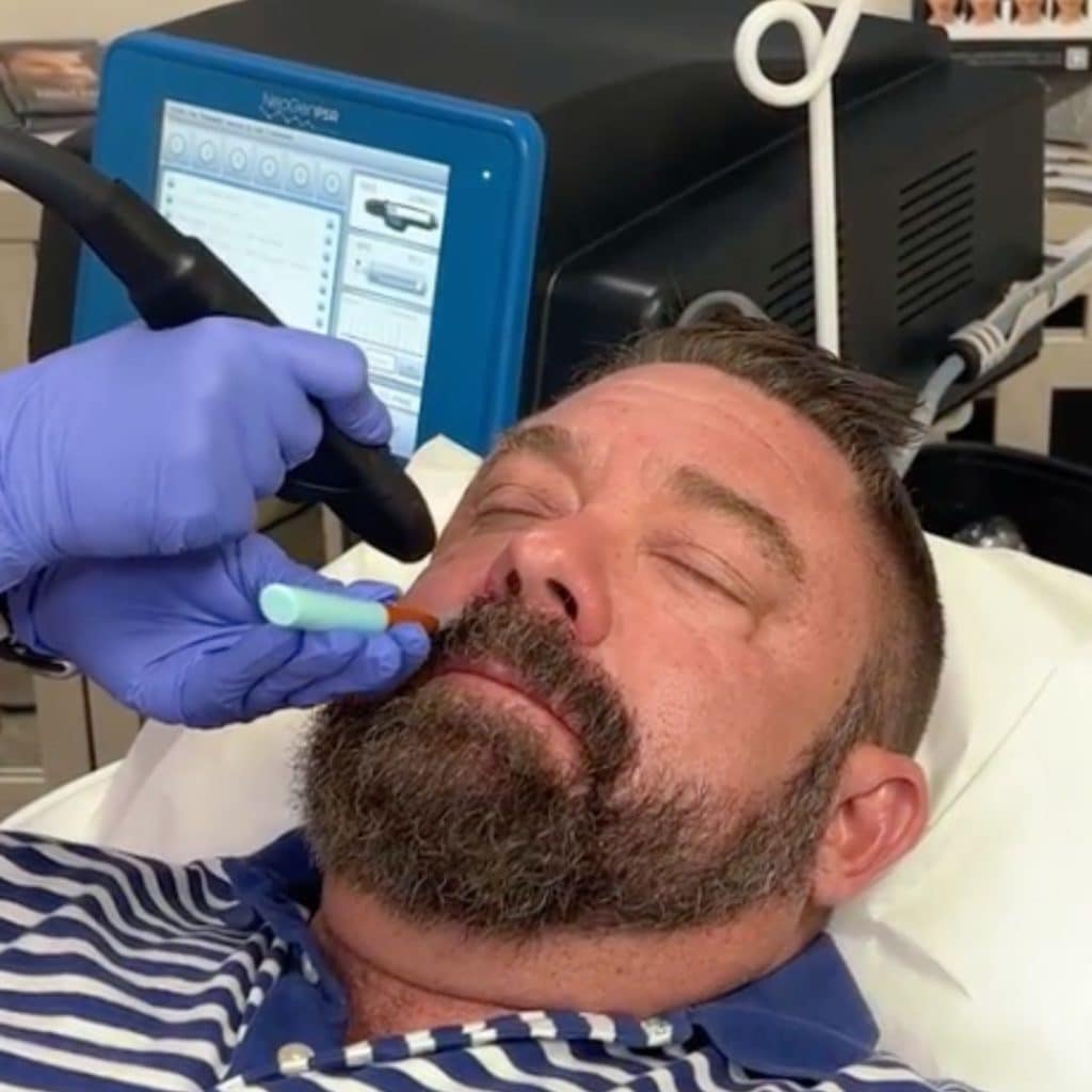 neogen facelift near key west