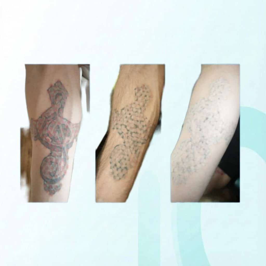 inkOUT Before & After Deck (5)