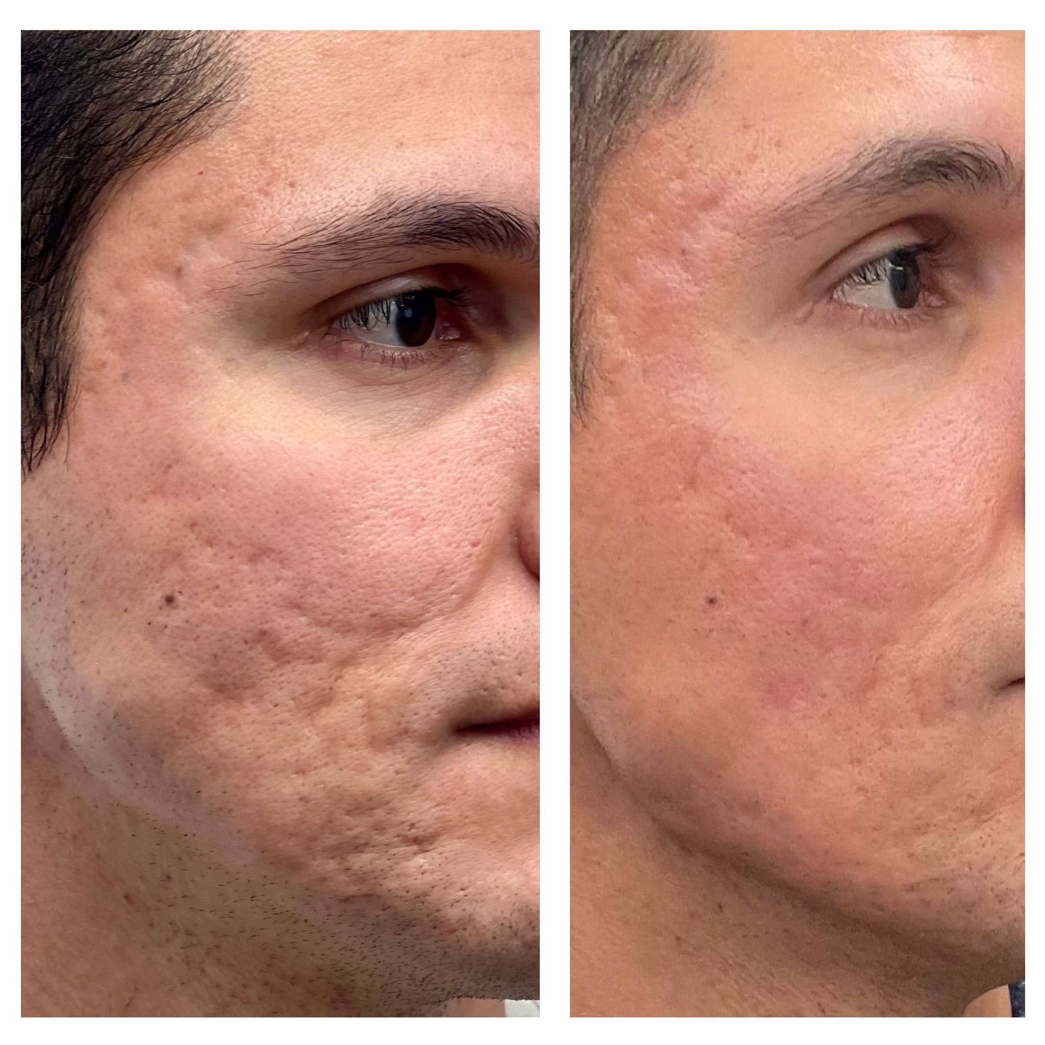 One of the first patients in the desert to receive the NeoGen procedure.